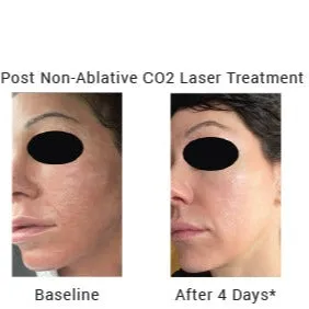 Hyaluronic Calming Serum