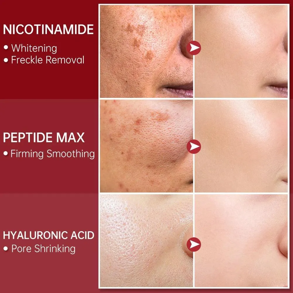 Youthful Glow Niacinamide Serum: Advanced Anti-Aging Skincare with Peptides